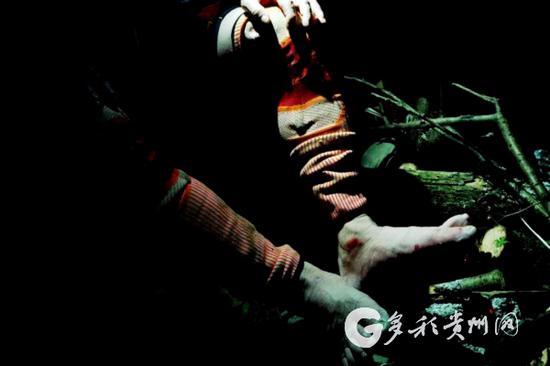 扶持东说念主员的脚长久浸泡水中,被岩石和树枝划伤
